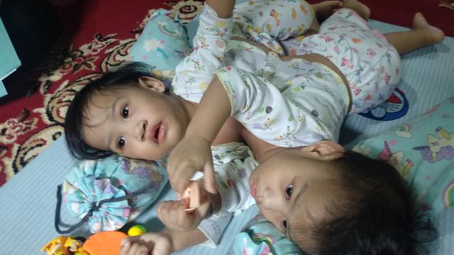 Bayi kembar siam Kendari saat bermain.(Liputan6.com/Ahmad Akbar Fua)
