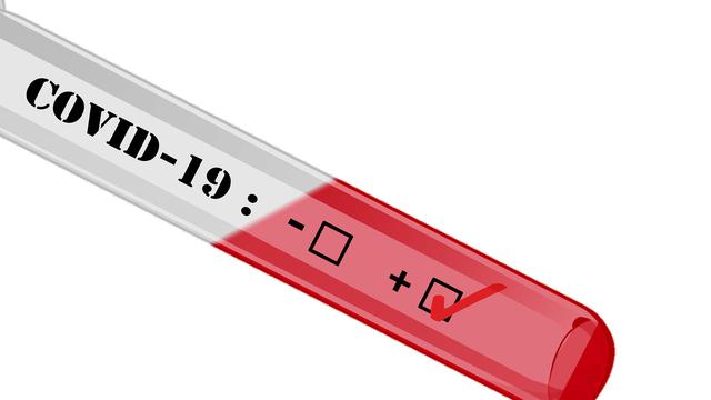 Ilustrasi Virus Corona