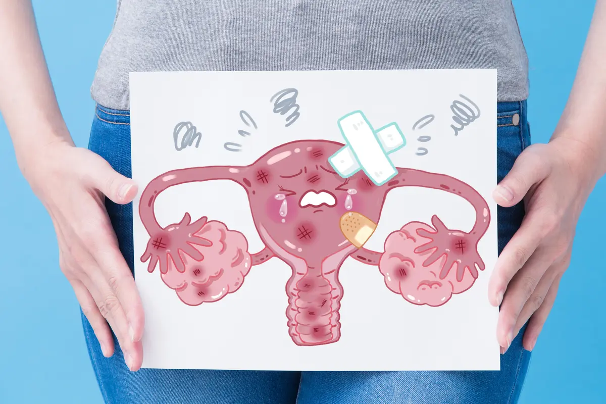 Tes HPV DNA Genotyping untuk Deteksi Infeksi HPV yang Menyebabkan Kanker Serviks