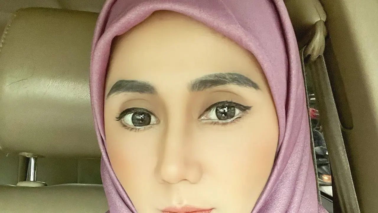 Aida Saskia Jalani Kemoterapi