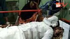 Seorang anak yang dibakar ayah kandungnya di Lhokseumawe, Aceh. Korban bernama Muhammad Amru dirujuk ke RSU Zainal Abidin, Banda Aceh. Korban dibakar sang ayah lantaran mencuri uang Rp 20 ribu. 