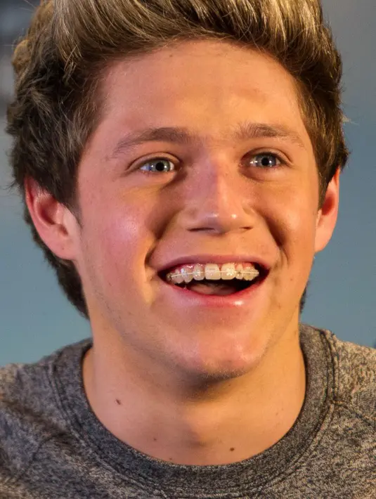 Kaki Niall Horan patah, bahkan dia tidak tahu mengapa hal itu terjadi dan bagaimana hal itu terjadi padanya. (Bintang/EPA)