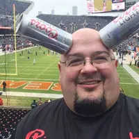 Punya kelainan, kulit laki-laki ini jadi 'magnet' bagi hampir semua benda.