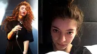 Lorde Tak Lepas dari Jerawat