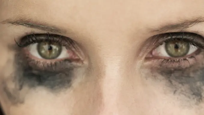 4 Masalah Kecantikan yang Datang Saat Musim Hujan