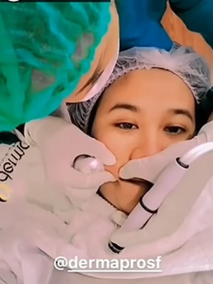 Makin Glow Up, Ini 6 Momen Mayang Perawatan Wajah Rp 80 Juta