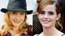 Emma Watson menggunakan kawat gigi di awal kariernya. (Pinterest)