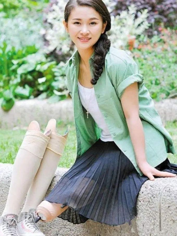 [Bintang] Cerita Haru di Balik Foto Wanita Cantik dengan Kaki Palsu