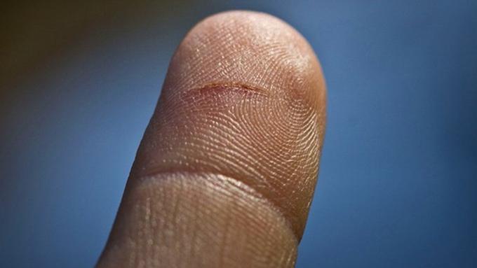 Kenapa Luka Jari Teriris Kertas (Paper Cut) Perihnya Kebangetan
