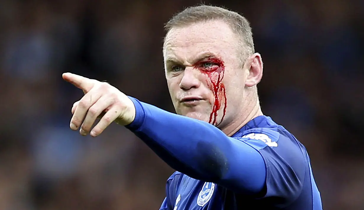 Striker Everton, Wayne Rooney, mengalami pendarahan di mata kirinya usai duel udara dengan bek Bournemouth, Simon Francis, pada Premier League, di Stadion Goodison Park, Sabtu (23/9/2017). Everton menang 2-1 atas Bournemouth. (AP/Barrington Coombs)