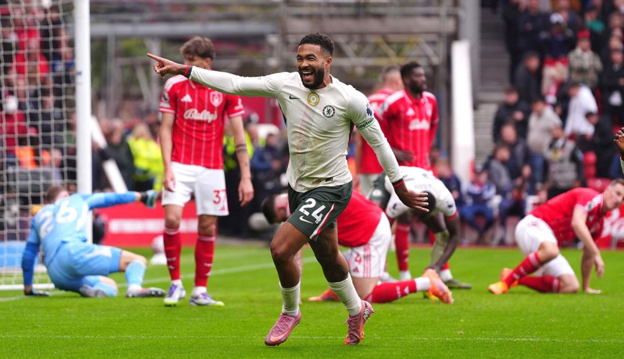 Keputusan ini diambil tak lama usai kekalahan 0-3 dari Chelsea di City Ground, Sabtu (18/10/2025) malam WIB. (Bradley Collyer/PA via AP)