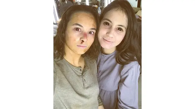 5 Potret Persahabatan Chelsea Islan dengan Pevita Pearce, Selalu Kompak