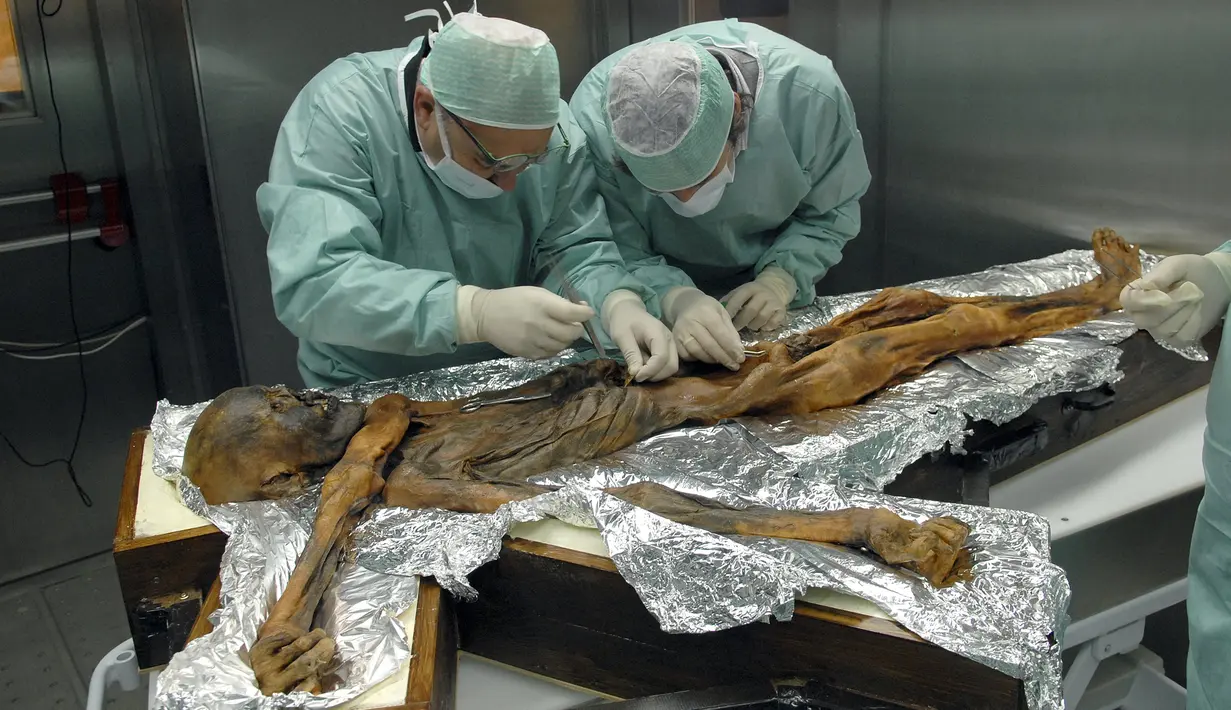 Ilmuwan memeriksa mumi Otzi di Museum Arkeolog EURAC, Bolzano, Italia, (4/1/2016). Ditemukannya struktur yang berbeda dari tubuh yang dimiliki manusia Otzi dan manusia modern. (REUTERS / Sudtiroler Archaeologiemuseum)