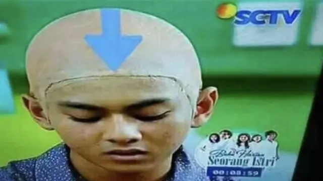 7 Editan Foto Rey Bong dengan Kepala Botak Oleh Netizen Ini Lucu