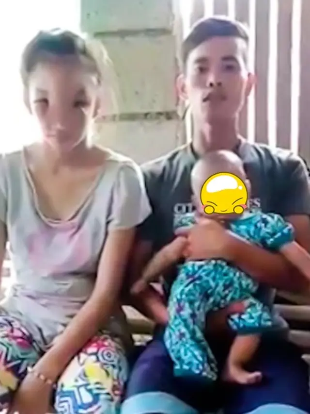 Viral, Wanita Ini Hampir Alami Kebutaan Usai Pencet Jerawat