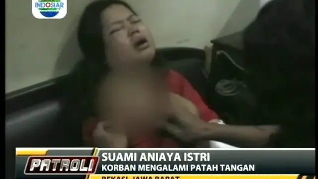 Suami Aniaya Istri, Korban Mengalami Patah Tangan