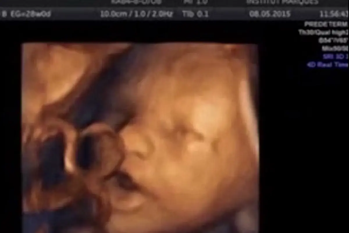 USG Aksi Menakjubkan Bayi Bernyanyi dalam Rahim