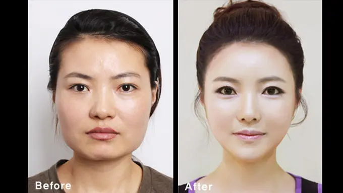 (c) kpsurgery tumblr.com