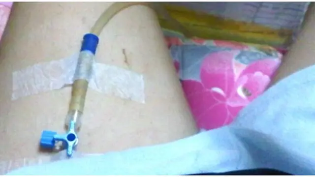 Foto: copyright chacha.com