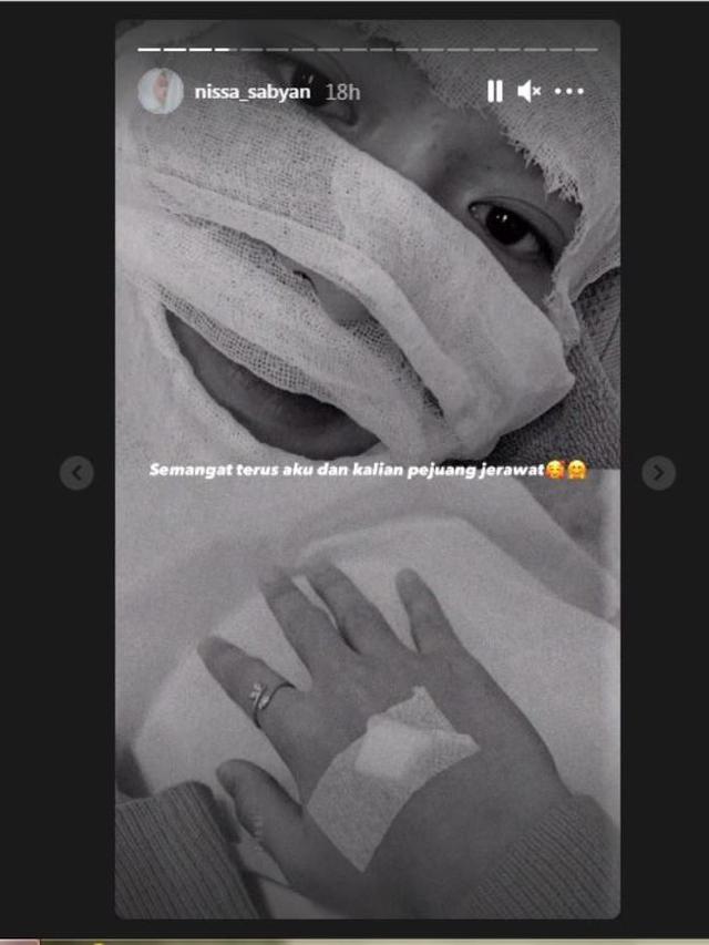 Wajah Nissa Sabyan Dipenuhi Perban