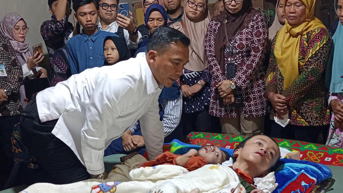 Tangani Segera, Hidrosefalus Ganggu Perkembangan Fisik dan Intelektual Anak