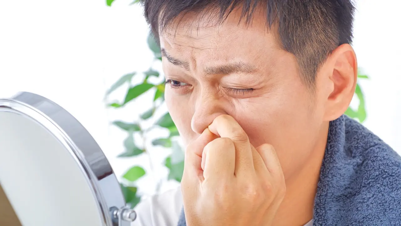 Jerawat di Hidung Pria, Ini Penyebab dan Cara Mengatasinya