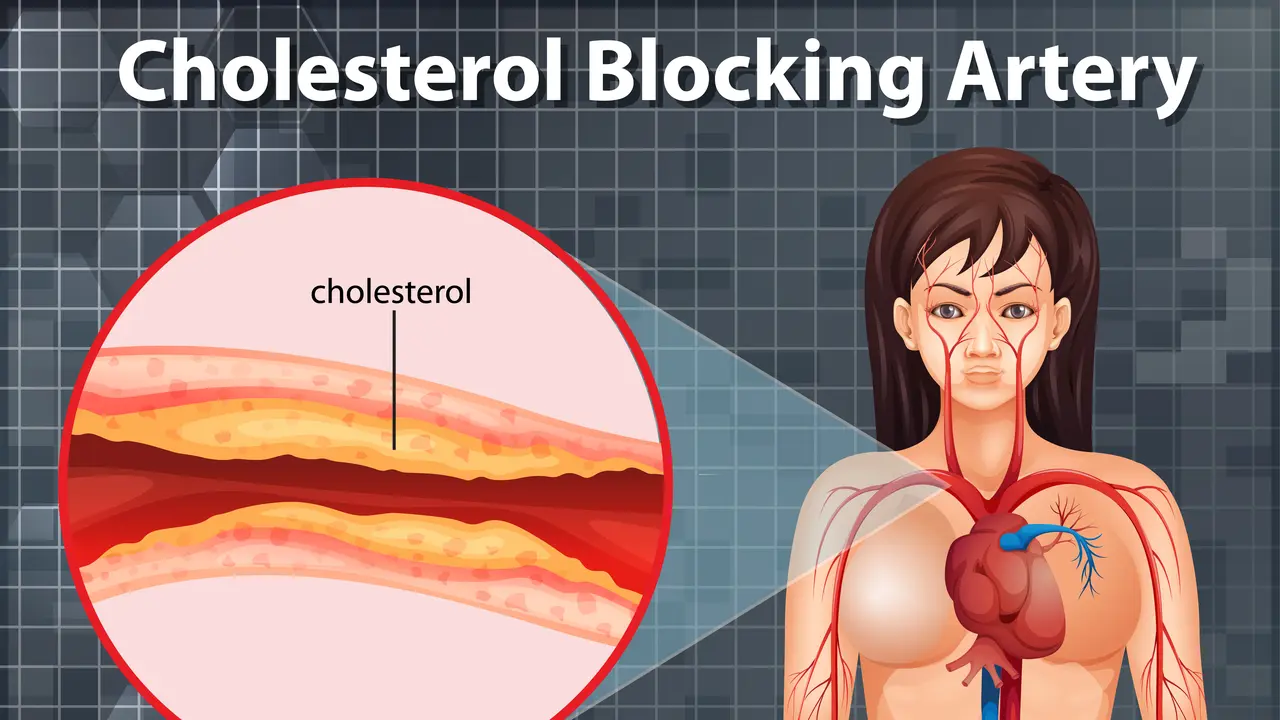 Ilustrasi kolesterol