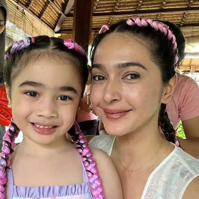 [Fimela] Raqeema Ruby Radinal