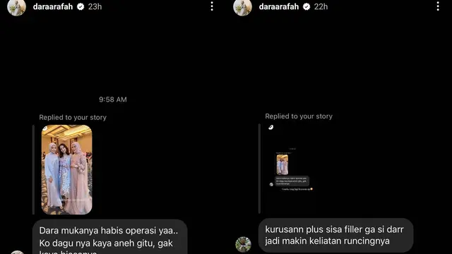 Foto Dara Arafah Dikira Netizen Oplas Dagu