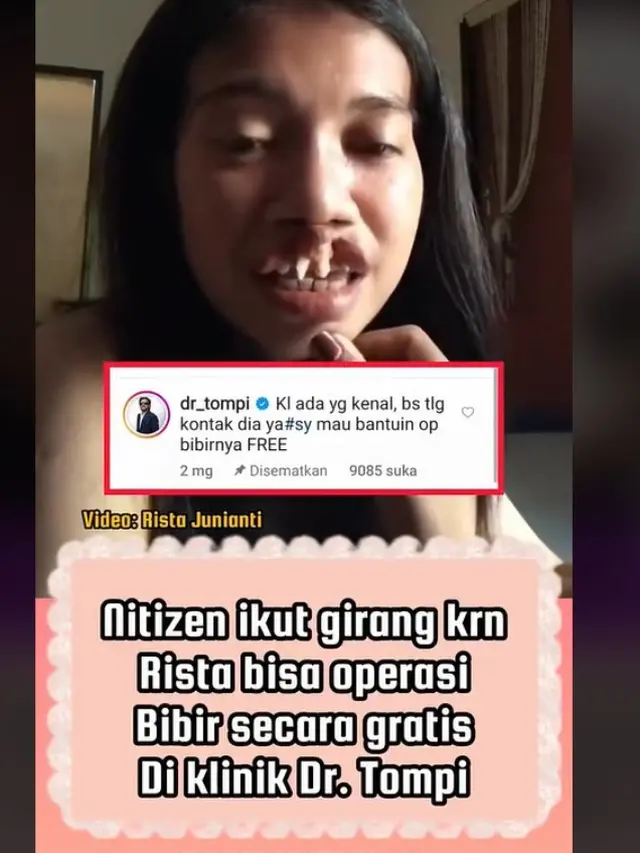 Viral Wanita Berbibir Sumbing Tapi Bersuara Merdu, Komentar Tompi Jadii Sorotan