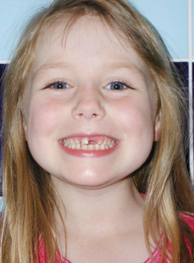 Rosie kecil kehilangan giginya saat memakan spons | foto: copyright mirror.co.uk