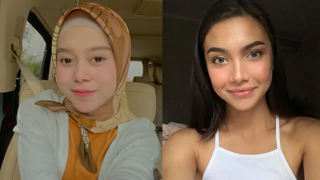 6 Seleb Ini Pernah Unggah Foto saat Wajah Berjerawat, Akui Tak Malu