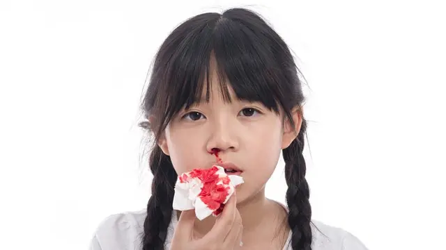 Tanda-tanda Anak yang Terkena Hemofilia (ANURAK PONGPATIME/Shutterstock)