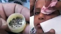 Batu Keluar dari Mata Gadis Saat Menangis, Warga Heboh Duga Sihir