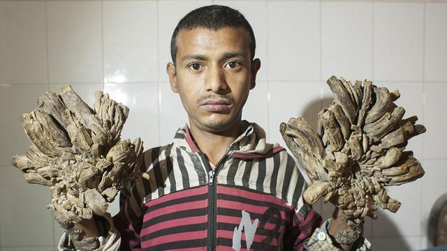 Perkenalkan Manusia Akar dari Bangladesh