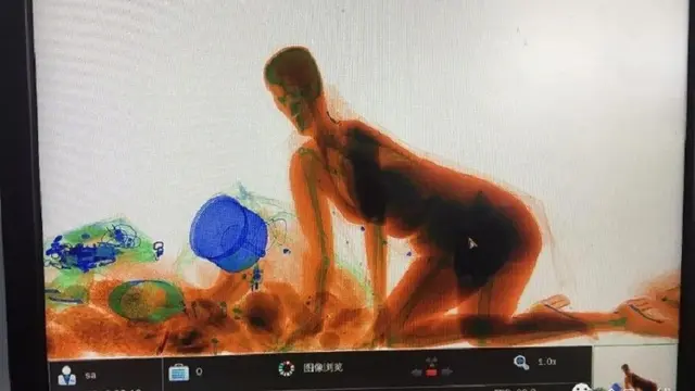 Kocak, Takut Tasnya Dicuri, Wanita Ini Masuk ke Mesin Sinar-X