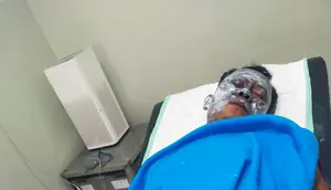 Seorang Pekerja Terbakar Akibat Ledakan Trafo
