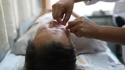 Pasien menerima perawatan akupunktur di rumah sakit di Shenyang di provinsi Liaoning, China (7/8). Akupunktur adalah komponen penting pengobatan tradisional Tiongkok, yang digunakan untuk mengobati berbagai macam penyakit. (AFP Photo/Str/China Out)