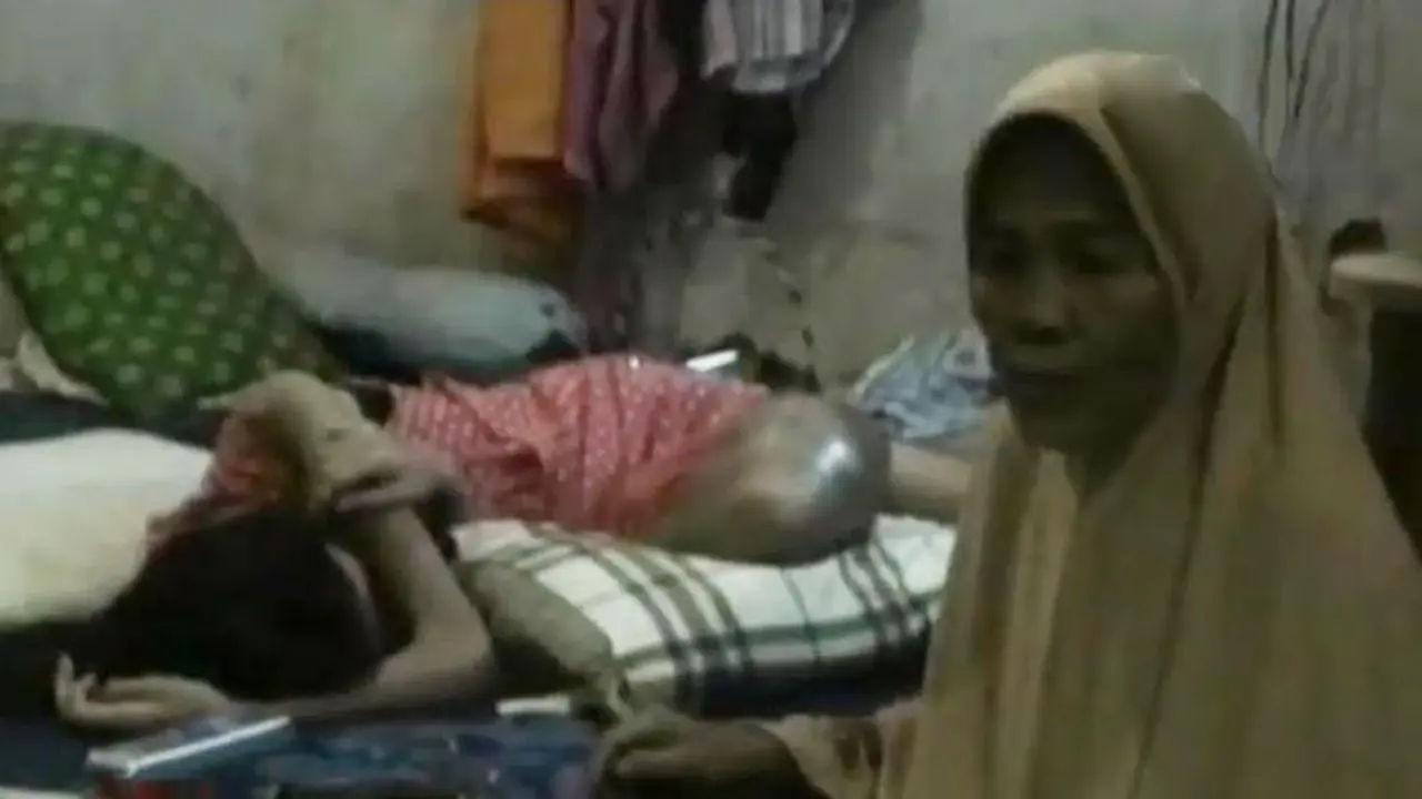 VIDEO: Terbentur Meja, Kaki Siswi SD Ini Terancam Diamputasi