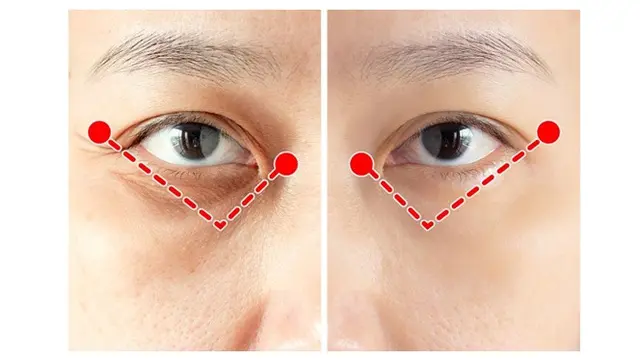 6 Fakta Unik Terapi Shiatsu, Cara Alami Orang Jepang Hilangkan Kerutan di Wajah