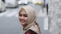 Begini Reaksi Teman-Teman Saat Rina Nose Lepas Hijab