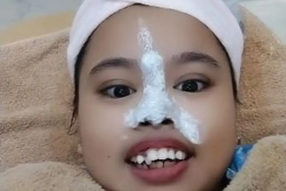 6 Potret Terbaru Kekeyi Setelah Filler Hidung, Tampil Beda