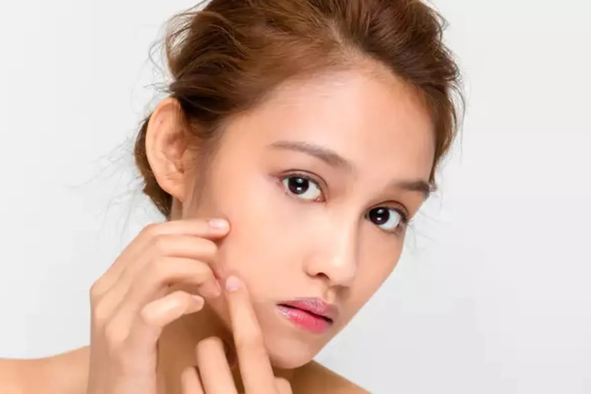FIMELA Beauty: Kulit wajah stres