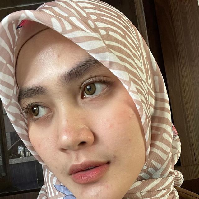 Henny Rahman Hamil dan Akui Wajahnya Berubah, Ini 6 Potret Terbarunya