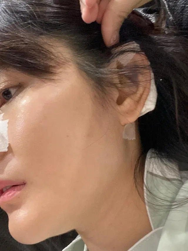 Akui Menyesal, Ini 6 Potret Terbaru Angela Lee Usai Operasi Plastik