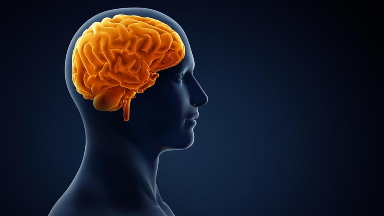 9 Penyebab Pendarahan Otak yang Dialami Tukul Arwana, Kenali Gejalanya