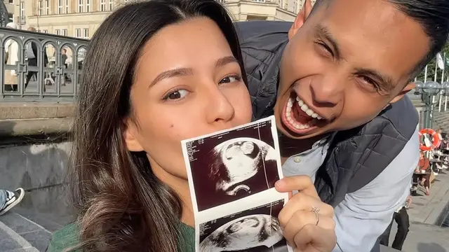 6 Potret Susan Sameh Umumkan Hamil Anak Pertama di Jerman, Pamerkan USG Calon Bayi
