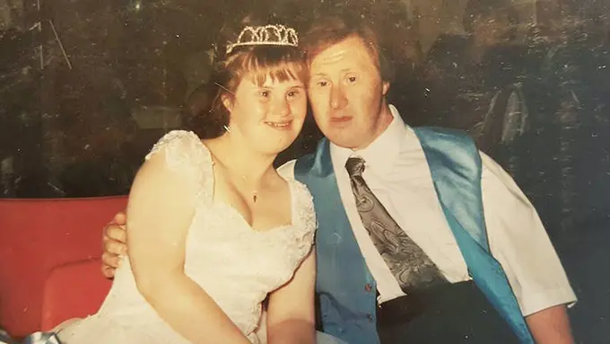 [Bintang] Down Syndrome