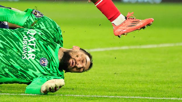 Foto: Detik-Detik Insiden Horor yang Menimpa Gianluigi Donnarumma, 10 Jahitan di Muka