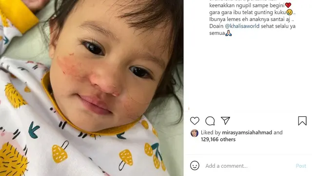 Kartika Putri (Foto: Instagram/@kartikaputriworld)